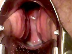 speculum, grote maten (bbw), masturbatie, close up